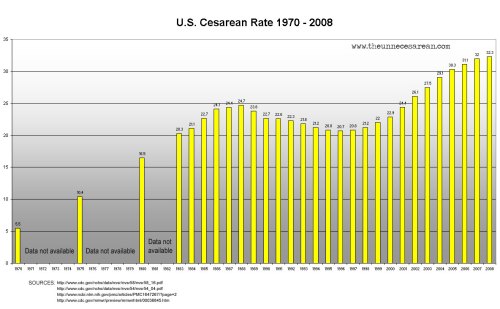 us_cesarean_rate