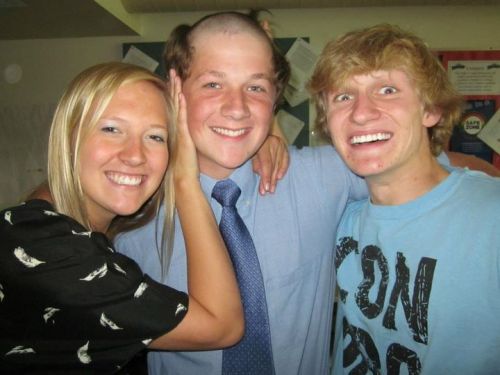 Jeff with male pattern baldness (2)